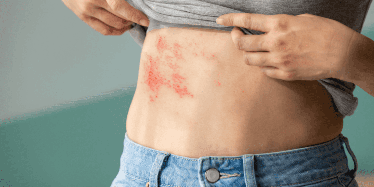 الحزام الناري.. هل أنت مستعد لمواجهة هذا العدو الخفي؟