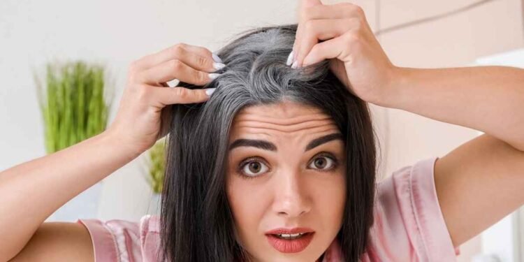 الشيب المبكر.. كيف تقضي على الشعر الأبيض نهائيًا؟