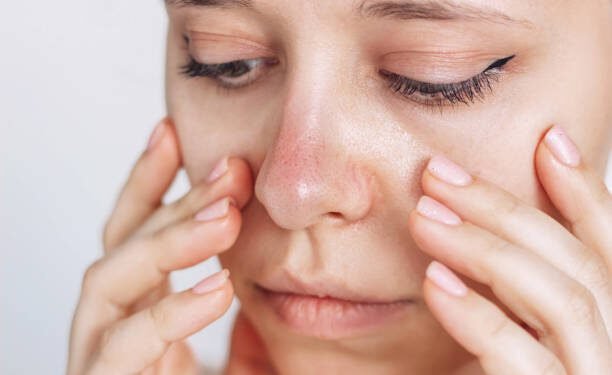 وداعًا لـ الرؤوس السوداء.. وصفات طبيعية لبشرة نضرة وصافية