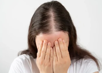 أعشاب تقوي الشعر من الجذور.. وداعًا للتساقط!