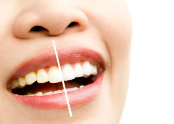 عادات خاطئة تسبب اصفرار الأسنان وكيف تحصل على ابتسامة ناصعة البياض