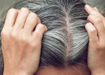 بدون صبغة.. أطعمة طبيعية تحارب الشعر الأبيض وتعيد لمعانه