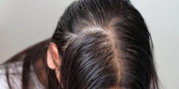 التخلص من فراغات الشعر.. طريقة مثالية لاستخدام جل الصبار