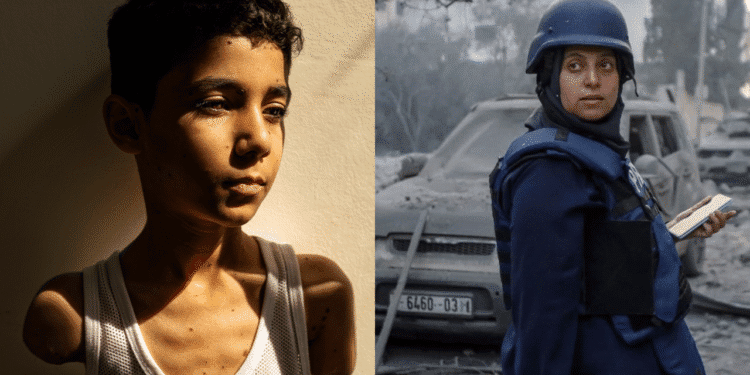 طفل مبتور الذراعين.. حكاية صورة أحرجت العالم