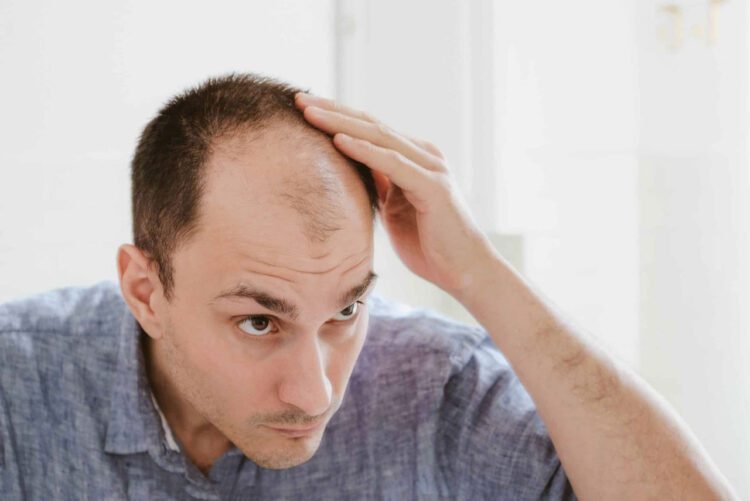 وصفات تقضي على الصلع للرجال وتستعيد كثافة الشعر