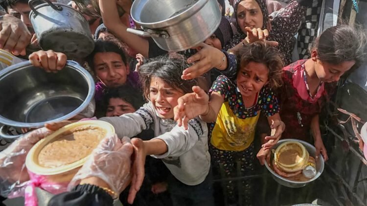 أطفال غزة يواجهون أوبئة القرن الماضي. متى أصبح التجويع سلاحاً معترفاً به دولياً ؟