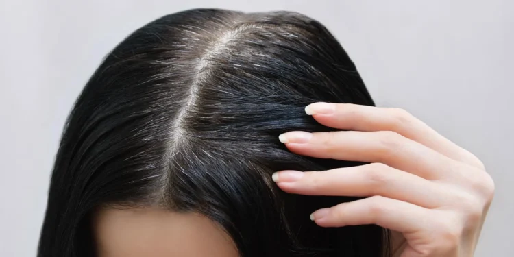 أطعمة سحرية تمنع الشيب المبكر.. سعر الشعر الصحي!