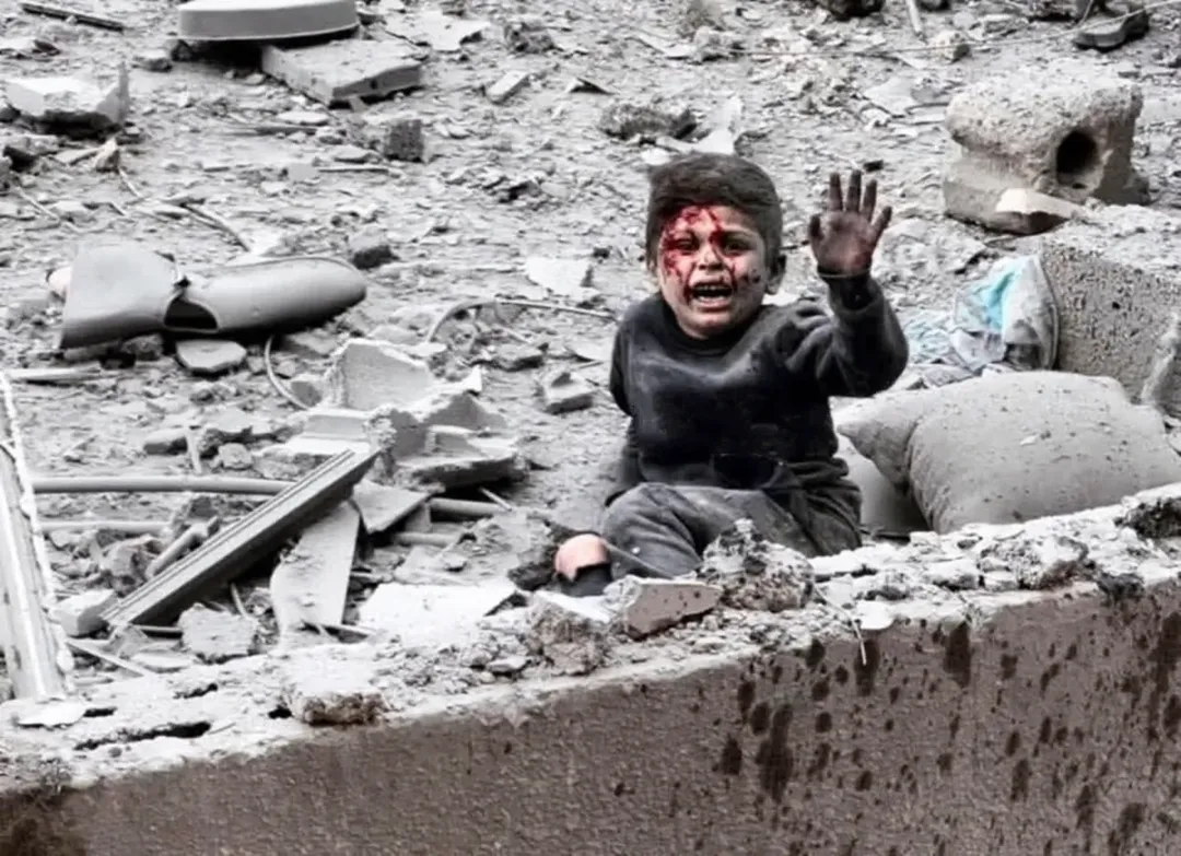 هذا الطفل تم استهداف شقتهم في مدينة غزة، قذفه شدة الإنفجار إلى سطح المبنى المجاور. ما ذنب هذا الطفل ليعيش هكذا لحظات قاسية في طفولته؟ 3