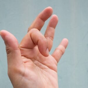 66ab2730451607c195053dd4 66ab2681cfc97e536f70d8fc picture of trigger finger