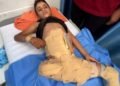 مأساة طفل من غزة.. “سند” يعيش بـ نصف جسد