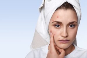 portrait young woman having problem skin pimple her cheek wearing towel her head having sad expression pointing scaled 1