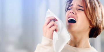 حساسية قاتلة.. 10 أعراض تنذر بالخطر