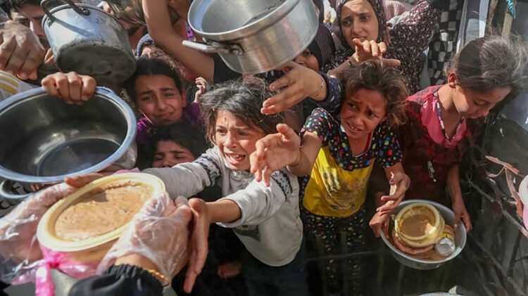أطفال غزة يواجهون أوبئة القرن الماضي. متى أصبح التجويع سلاحاً معترفاً به دولياً ؟