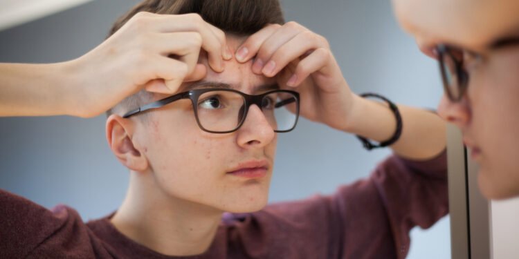 لا بلوغ ولا شم.. متلازمة كالمان تصيب المراهقين!