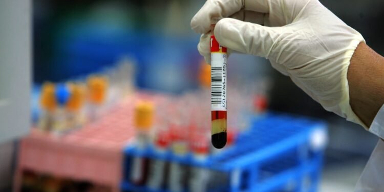 وداعًا لـ الكوليسترول الضار.. 5 أطعمة سحرية تخفض النسبة