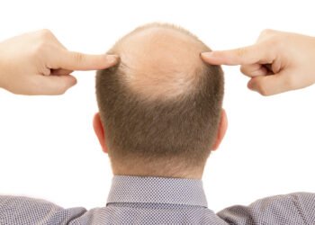 أخطاء شائعة تسرع تساقط الشعر
