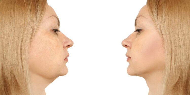 وداعًا لـ الذقن المزدوجة.. تدليك الوجه سر النضارة