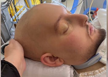 أستاذ قلب يكشف: هذا سبب وفاة الأمير النائم