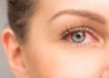 احمرار العينين.. إليك العلاج والوقاية