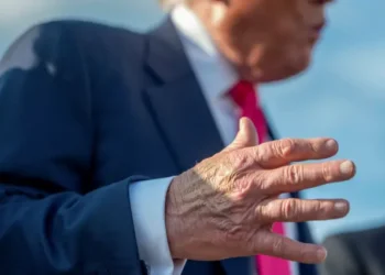 مرض ترامب الجديد.. أعراض القصور الوريدي المزمن