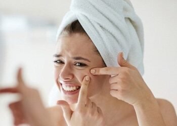 ودعي حب الشباب.. وصفات طبيعية من مطبخك