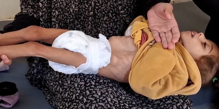 الطفلة شام ليست وحدها.. غزة تودع أبناءها جوعاً وعطشاً