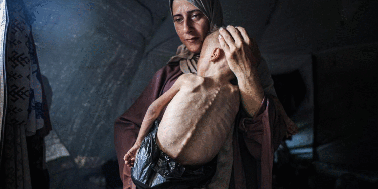 كارثة إنسانية غير مسبوقة.. المجاعة تتفشى في غزة