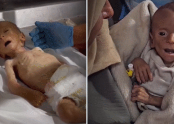 الرضع يودعون الحياة.. حكاية عيد أبو جامع ضحية الجوع