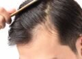 علاج تساقط الشعر في 20 يوم فقط.. اكتشاف سحري
