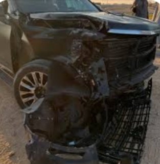 أحمد سعد يتعرض لحادث مروع.. آخر تطورات حالته الصحية (صور)