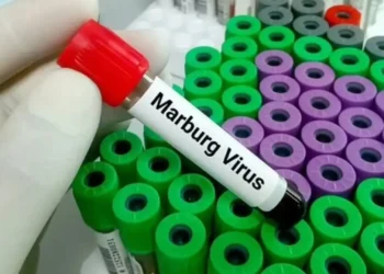 «ماربورغ» الإثيوبي يثير الذعر.. ماذا فعلت مصر لمنع تسلل الفيروس القاتل؟