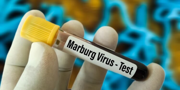 فيروس ماربورغ.. قصة العدوى التي تثير القلق عالميًا