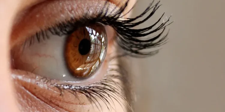 4 علامات في العين تحذرك بارتفاع الكوليسترول