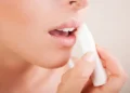 علاج تشقق الشفاه.. وداعاً للنزيف والآلام