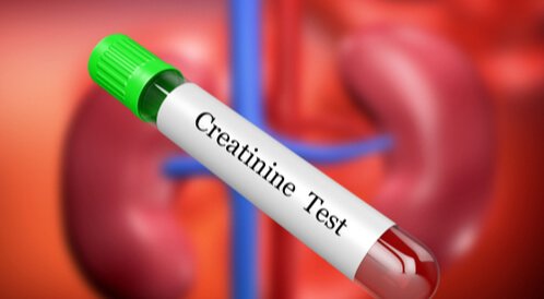 الكرياتينين.. ترمومتر صحة الكلى ودليلك لفهم إنذارات الجسد المبكرة