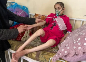 المجاعة تتفاقم.. تداعيات سوء التغذية على جيل كامل في غزة