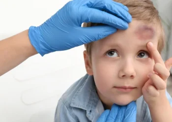 الهيموفيليا عند الأطفال.. علامات تحذيرية لا تتجاهليها