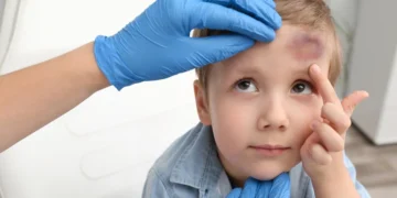 الهيموفيليا عند الأطفال.. علامات تحذيرية لا تتجاهليها