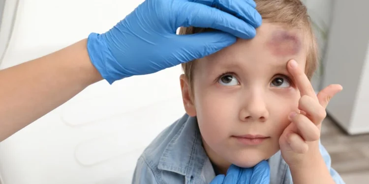 الهيموفيليا عند الأطفال.. علامات تحذيرية لا تتجاهليها