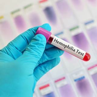 الهيموفيليا عند الأطفال.. علامات تحذيرية لا تتجاهليها