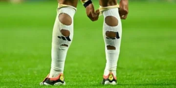 سر تمزيق اللاعبين جواربهم في كأس العالم 2026