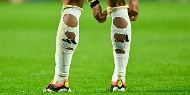 سر تمزيق اللاعبين جواربهم في كأس العالم 2026
