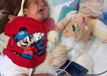 أصغر ضحايا الاحتلال.. الرضيع محمد يجسد مأساة الأطفال مبتوري الأطراف