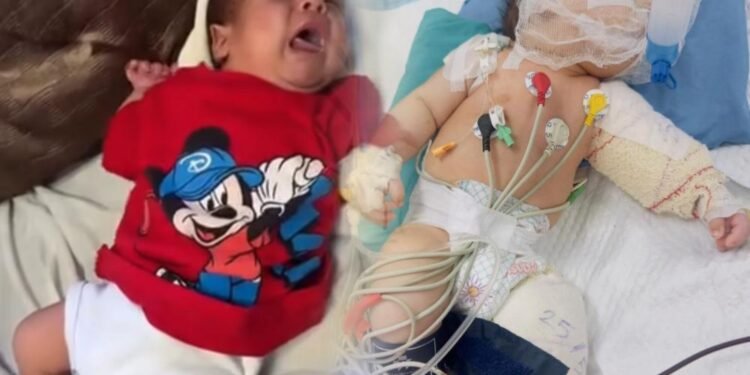 أصغر ضحايا الاحتلال.. الرضيع محمد يجسد مأساة الأطفال مبتوري الأطراف