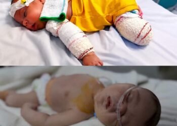 محمد وبيلسان.. حكاية رضيع فقد أمه وقدمه وطفلة تصارع الموت في غزة