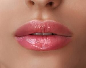Images (14)